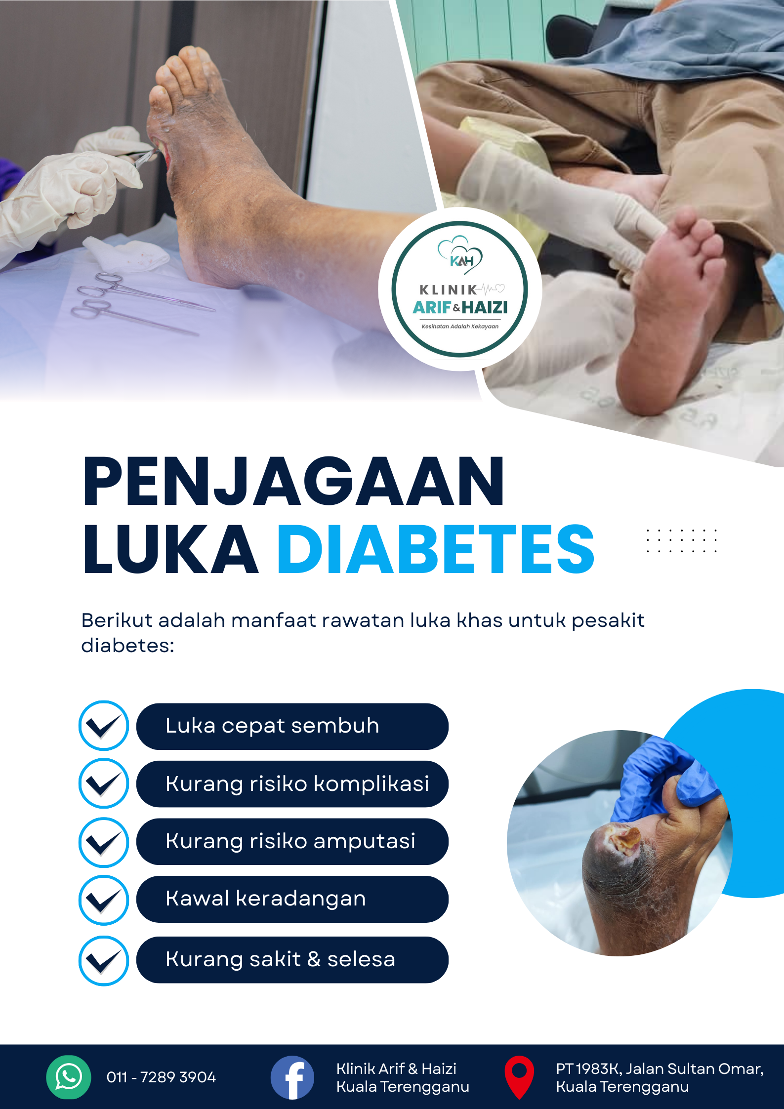 PENJAGAAN LUKA DIABETES